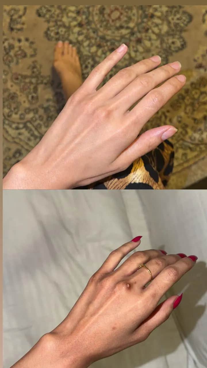 Customer-shared hand comparison photographs arranged vertically