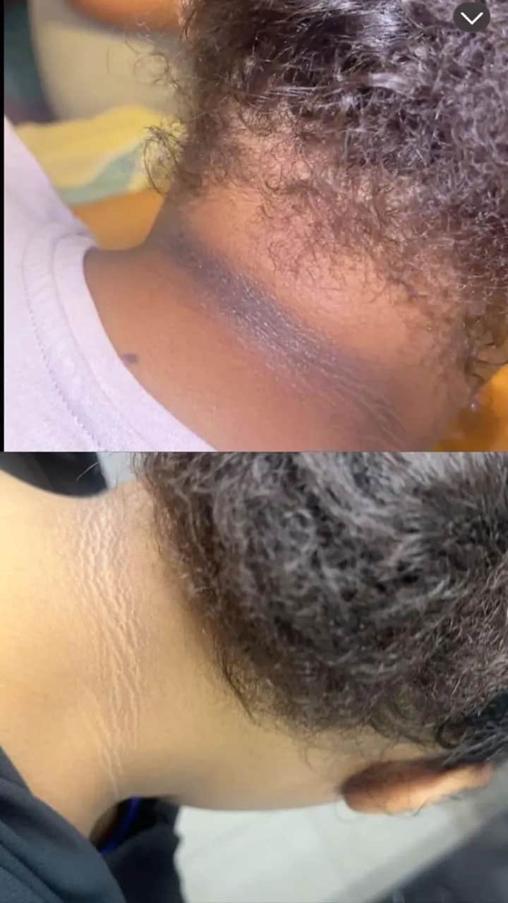 Customer-shared neck comparison photographs arranged vertically