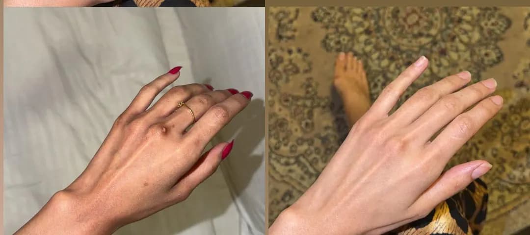 Genuine customer-shared hand photos showing before on the left and after on the right